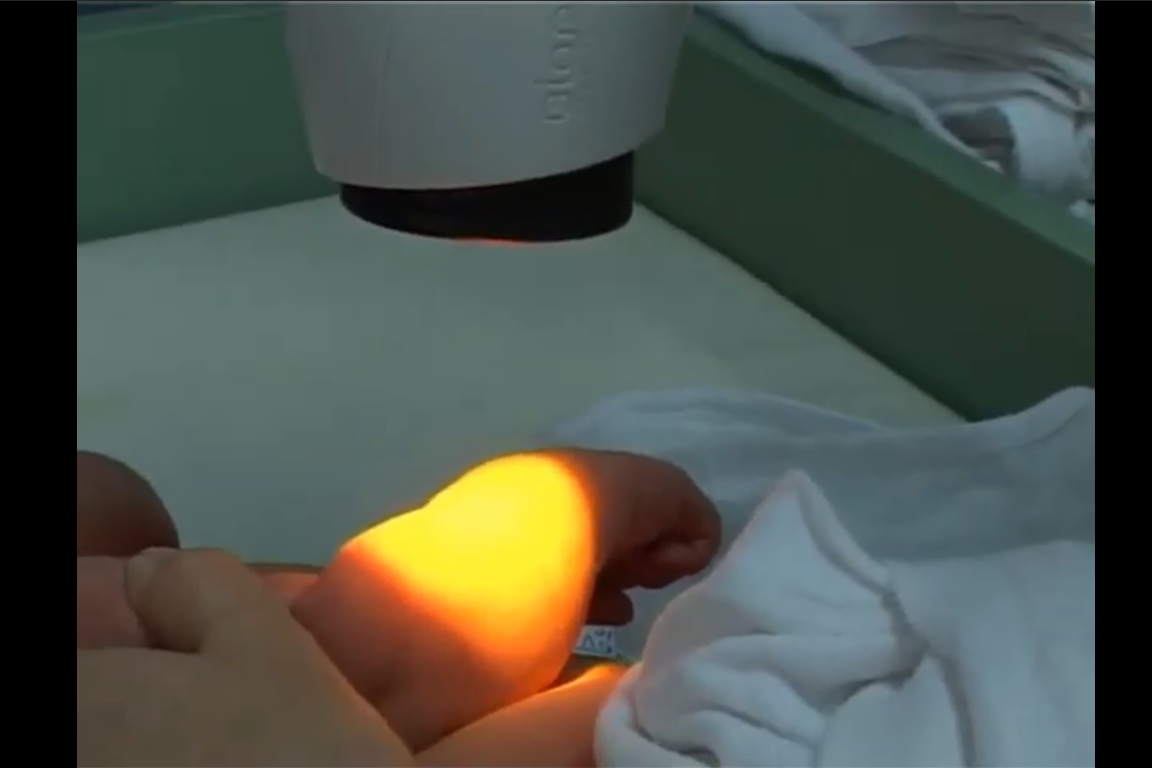 Macierzyństwo - lecz dzieci od urodzenia Lampą Bioptron